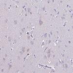 ACTRT3 Antibody in Immunohistochemistry (Paraffin) (IHC (P))