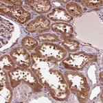 PCDHGB3 Polyclonal Antibody