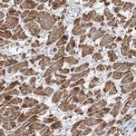 PPP2R3A Antibody in Immunohistochemistry (Paraffin) (IHC (P))