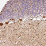 SLC20A1 Antibody in Immunohistochemistry (Paraffin) (IHC (P))