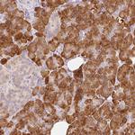 SLC20A1 Antibody in Immunohistochemistry (Paraffin) (IHC (P))