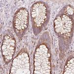 SLC20A1 Antibody in Immunohistochemistry (Paraffin) (IHC (P))