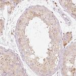 SLC20A1 Polyclonal Antibody