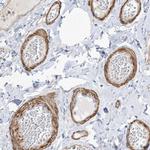 GTF3C2 Polyclonal Antibody