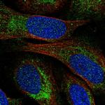 C4orf14 Antibody in Immunocytochemistry (ICC/IF)