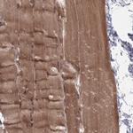 C4orf14 Antibody in Immunohistochemistry (Paraffin) (IHC (P))