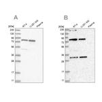C4orf14 Antibody in Western Blot (WB)