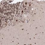 C4orf14 Antibody in Immunohistochemistry (Paraffin) (IHC (P))