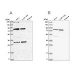 C4orf14 Antibody in Western Blot (WB)