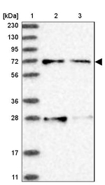 ACOX3 Antibody in Western Blot (WB)