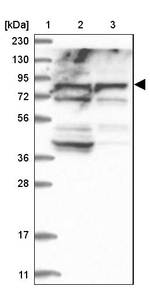 ACOX3 Antibody in Western Blot (WB)