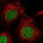 USP53 Polyclonal Antibody