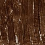 USP53 Antibody in Immunohistochemistry (IHC)