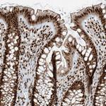 FAM193B Antibody in Immunohistochemistry (IHC)