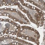 GCC2 Antibody in Immunohistochemistry (Paraffin) (IHC (P))
