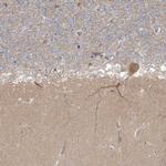 TRIM2 Polyclonal Antibody