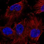 TRIM2 Polyclonal Antibody