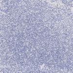 TRIM2 Antibody in Immunohistochemistry (Paraffin) (IHC (P))