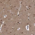 TRIM2 Antibody in Immunohistochemistry (IHC)
