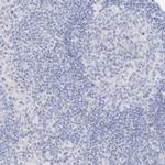 TRIM2 Antibody in Immunohistochemistry (IHC)