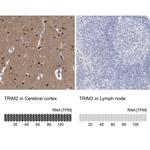 TRIM2 Antibody