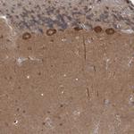 TRIM2 Antibody in Immunohistochemistry (IHC)