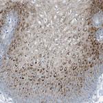 FAM162A Antibody in Immunohistochemistry (IHC)