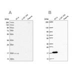 FAM162A Antibody in Western Blot (WB)