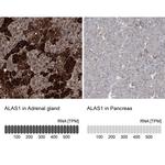 ALAS1 Antibody