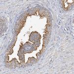 SIDT1 Antibody in Immunohistochemistry (Paraffin) (IHC (P))