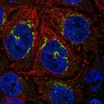 RBP2 Polyclonal Antibody