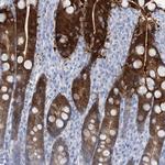 RBP2 Antibody in Immunohistochemistry (Paraffin) (IHC (P))