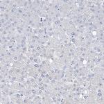 RBP2 Antibody in Immunohistochemistry (Paraffin) (IHC (P))