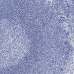 RBP2 Antibody in Immunohistochemistry (Paraffin) (IHC (P))