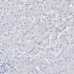 RBP2 Antibody in Immunohistochemistry (IHC)