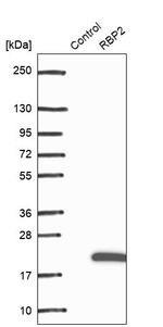 RBP2 Antibody in Western Blot (WB)
