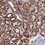 IFT80 Polyclonal Antibody