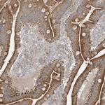 THG1L Polyclonal Antibody