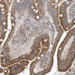 THG1L Antibody in Immunohistochemistry (IHC)