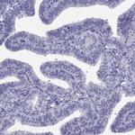 LYAR Antibody in Immunohistochemistry (Paraffin) (IHC (P))