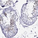 LYAR Antibody in Immunohistochemistry (IHC)