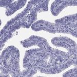 LYAR Antibody in Immunohistochemistry (IHC)