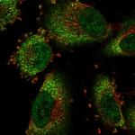 COMMD8 Polyclonal Antibody