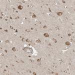 COMMD8 Antibody in Immunohistochemistry (Paraffin) (IHC (P))