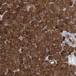 COMMD8 Antibody in Immunohistochemistry (Paraffin) (IHC (P))