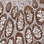 COMMD8 Antibody in Immunohistochemistry (Paraffin) (IHC (P))