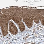 COMMD8 Antibody in Immunohistochemistry (Paraffin) (IHC (P))