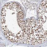 C1orf177 Polyclonal Antibody