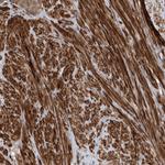 UBTD2 Antibody in Immunohistochemistry (Paraffin) (IHC (P))
