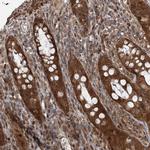 UBTD2 Antibody in Immunohistochemistry (Paraffin) (IHC (P))